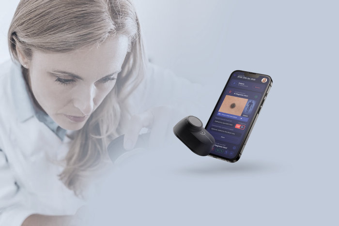 SmartVisSolution App
